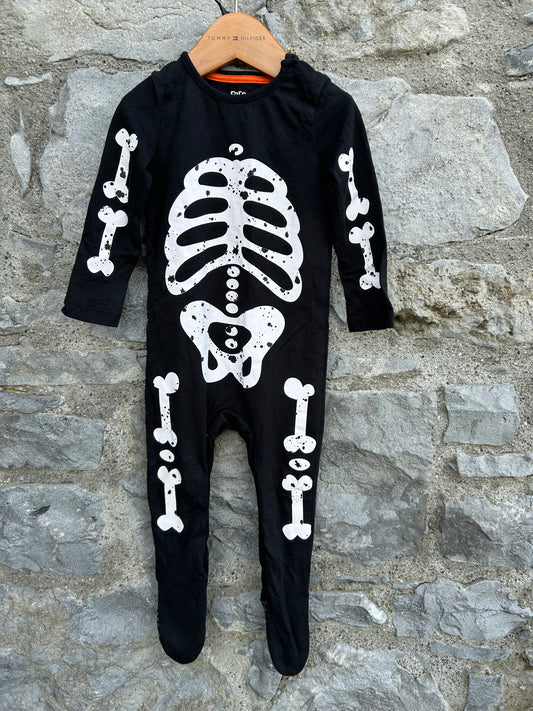 Skeleton onesie 9-12m (74-80cm)